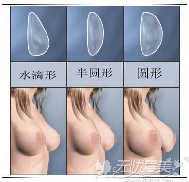 各种隆胸假体的形状
