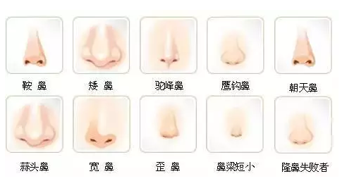 韩国宝士丽鼻综合手术可以改善鼻型