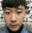 记录我在韩国宝士丽做眼鼻整形+面部术后一周恢复