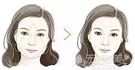 赣州韩美菱形脸注射美容方案