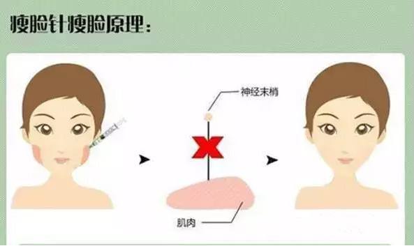 上海星和医疗美容注射瘦脸