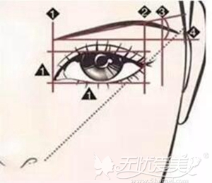 杭州靜娇韩式双眼皮手术