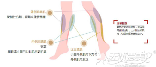 瘦腿对肌肉型腿