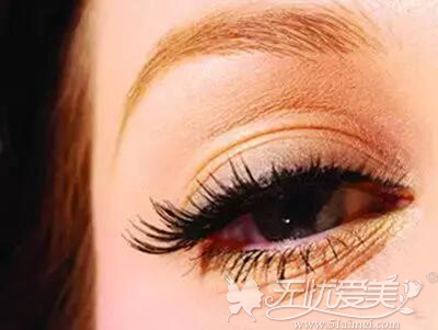 沈阳曙光做双眼皮好吗？杨威院长让你体会货真价实的效果
