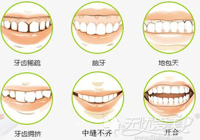 南宁爱思特牙齿矫正怎么样？想变美的话那你一定要尝试