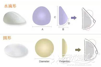 北京卓新华星假体丰胸手术