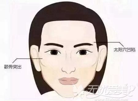 重庆星宸做面部脂肪填充怎么样?有没有案例?找哪位医生?