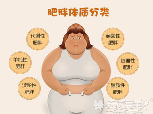 肥胖体质的分类