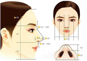南宁熠美假体隆鼻的手术过程
