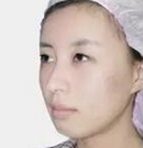 分享我在韩国清潭优做眼鼻手术+下巴整形+面部提升全过程