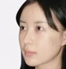 分享我在韩国清潭优做眼鼻手术+下巴整形+面部提升全过程