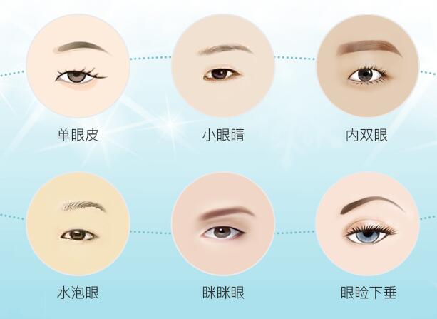 北京华悦府双眼皮手术可以改善眼形