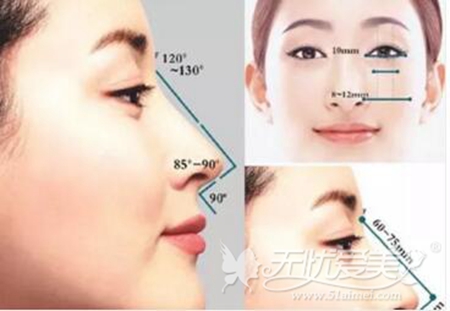 内江达芬奇隆鼻手术设计标准