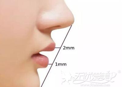 东莞缔美整形鼻综合的标准