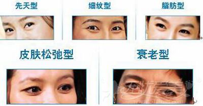 北京溪峰聚美仕去眼袋的手术方法