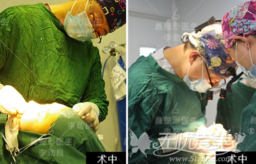 在北京柏丽做面部脂肪填充+鼻综合+瘦脸针手术中