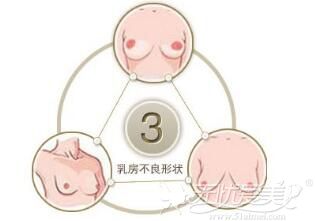 北京欧兰美假体隆胸手术的3种方法