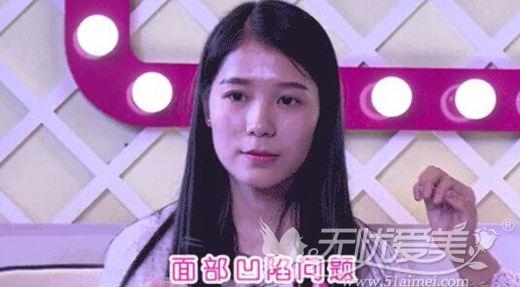 长沙雅美面部凹陷的顾客