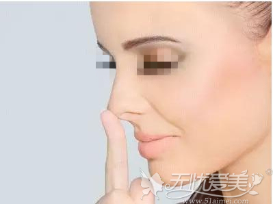 在襄阳悦美整形做了假体隆鼻后鼻子可以碰吗？