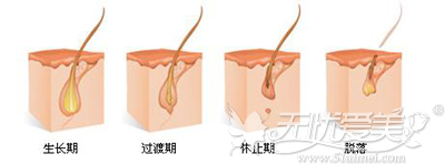 广州华美用案例让你能明白e光脱毛和冰点脱毛哪个好