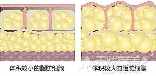 深圳阳光解析脂肪细胞的大小对比