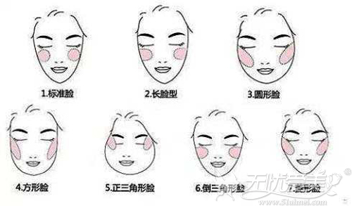 下颌角问题引发的各种脸型