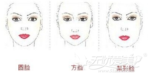 广州海峡长曲线下颌角整形手术适合脸型