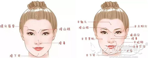 玻尿酸能填充面部的位置