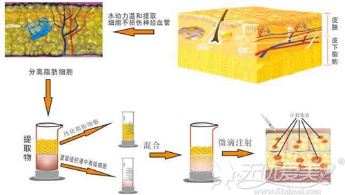 在南京做脸部脂肪填充后多久可以洗脸？艺星yestar为您解答