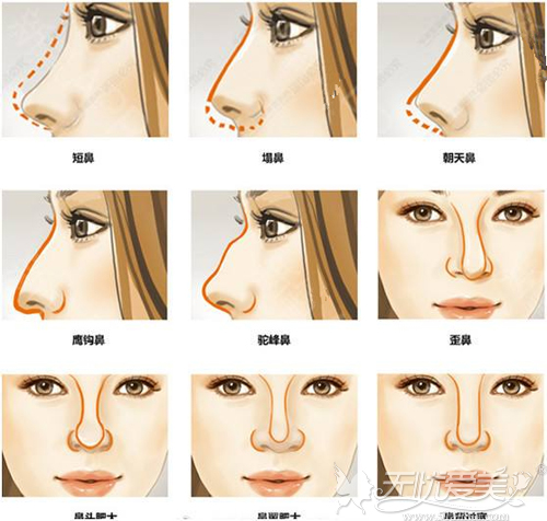 鼻子的各种短处很容易陷进误区