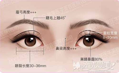 混血风格双眼皮需符合的眼部美学原理