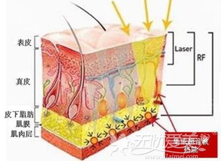 周口华美激光美肤除皱