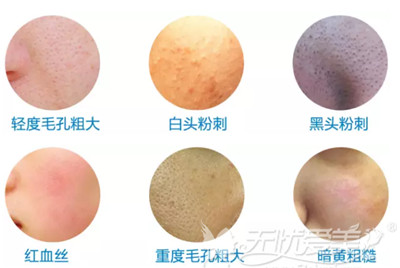 上海韩镜付瑾院长解析皮肤出现问题的类别