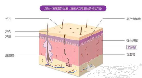 玻尿酸是一种本事存在于人体的物质