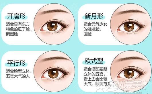 佛山佳丽韩式双眼皮可以改善形态