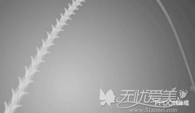 哈尔滨面部埋线提升哪家做的好?线雕提升后有什么副作用?