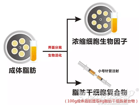 PTC 自体因子提取