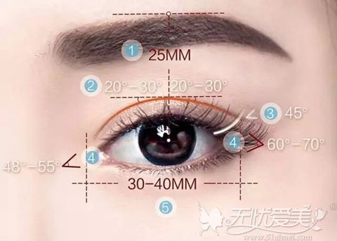 北京美莱整形双眼皮手术
