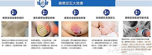 广州荔湾人民医院取奥美定技术怎么样?胸部的能全部取出吗