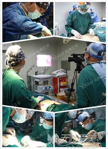 杭州艺星整形内窥镜隆胸手术过程