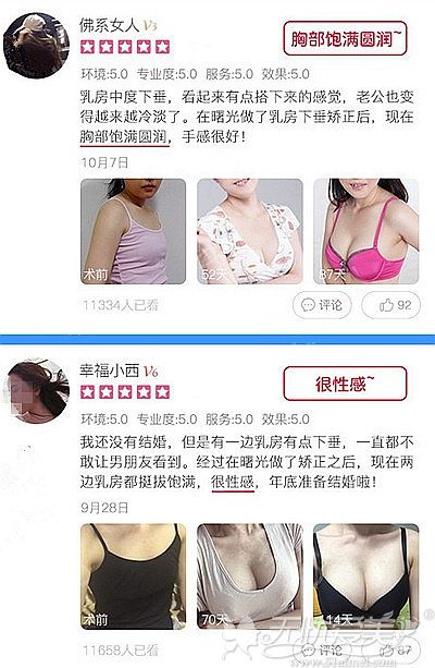 大众对宁夏华美乳房提升术的评价