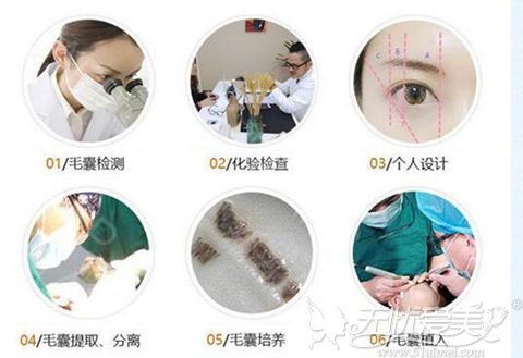 长沙脸博士25GHD眉毛种植技术
