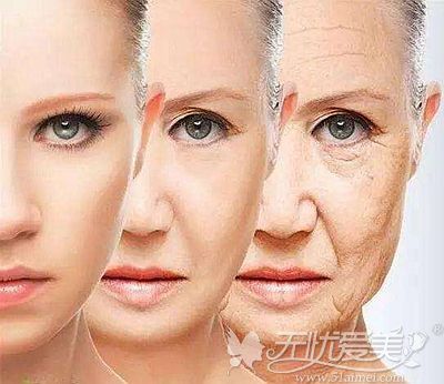 面部衰老出现的各种皮肤问题