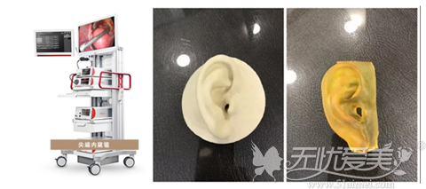 韩国普罗菲耳整形郑在皓用3D雕刻耳朵模型
