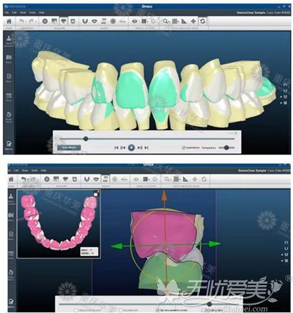 重庆华美数字化模拟牙齿系统