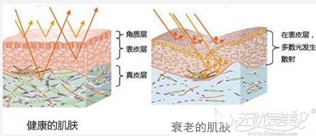 预防颈纹要做好防晒