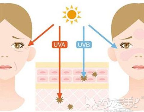 紫外线对皮肤暴晒造成晒斑还会加速皮肤衰老