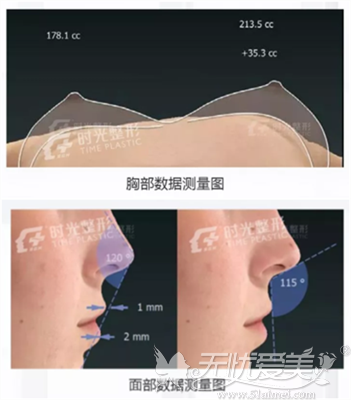上海时光整形胸部、鼻部测量图