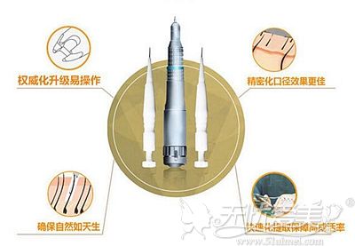 保定蓝山发际线种植的优势