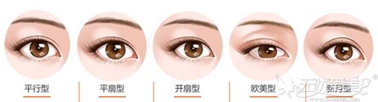 亳州微悦双眼皮手术类型